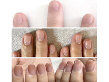 スターネイル(Starnail)/ネイルケア育成からジェルで美爪