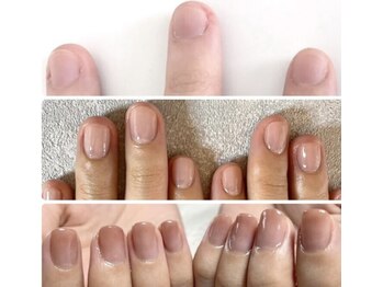 ネイルケア育成からジェルで美爪