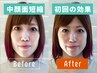 【切らない中顔面短縮】大好評メニューの中顔面を短縮する美顔デザイン構築術