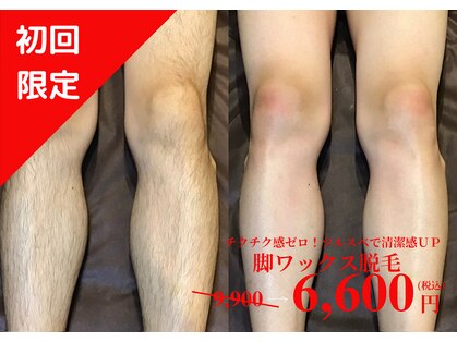 メンズ エステティック ヒーロー(men's esthetic HERO)の写真