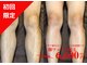 メンズ エステティック ヒーロー(men's esthetic HERO)の写真