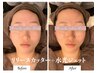 【フェイシャル&シェービング】結果重視★小顔リフト・輝く水光肌・透明感♪