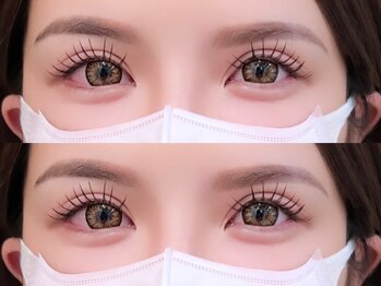 エイシェルの写真/あなたの目元をもっと美しく。自然でありながら、どの角度から見ても美しい目を引く仕上がりを実現します♪