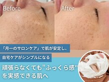内側から保湿されることで毛穴が目立ちにくい《ふっくら肌》に☆