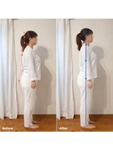 ブリリアントスマイル/猫背でお悩みの方　骨盤矯正　