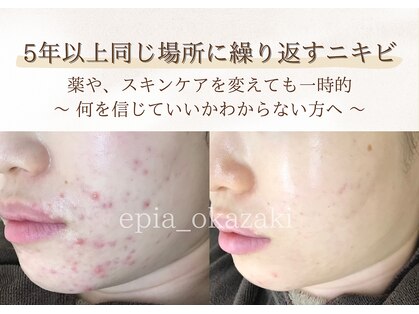 エピア 岡崎店(Epia)の写真