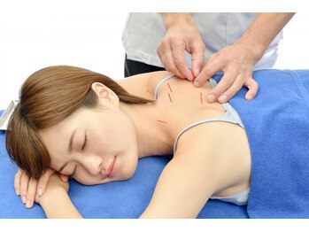 ひのくま鍼灸整骨院の写真/女性鍼灸師による鍼灸施術再開！お試し体験￥1,000から☆肩こり・腰痛・頭痛改善◎美容鍼も導入予定