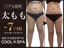 クールスパ(COOL SPA)