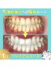 《人気No.1◎圧倒的美白》プレミアムホワイト10分×3回 ¥14,940 → ¥6,000