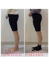 スタイルラボ高松/産後骨盤矯正の効果♪