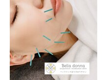 ベッラドンナ(Bella donna)の雰囲気（電気を流す美容鍼でたるみ、ほうれい線の改善、肌質改善も◎）