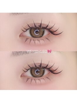 ケーケーエスビューティー(KKS Beauty)/ダブルフラット/バインドロック