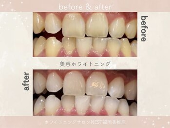 ホワイトニングショップ 福岡香椎店/美容ホワイトニングサロン