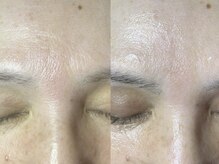 ドゥナ(DUNA)/生コラーゲン