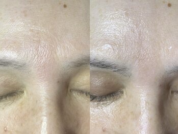 ドゥナ(DUNA)/生コラーゲン