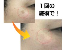 掲載写真は実際の写真ですが、個人差有り