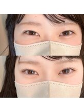 サロン ザ カフー(salon the KAFUU)/ラッシュリフト（まつ毛パーマ）