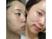 リリーガーデン(Lily Garden)/