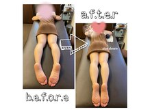 アンドユー カゴシマ(&you kagoshima)の雰囲気（施術による姿勢変化）