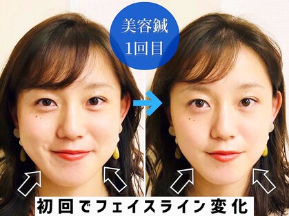 アオヤマ サロン ワイゼット(AOYAMA SALON YZ)の写真