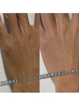 ブラックスワン(Black Swan)/