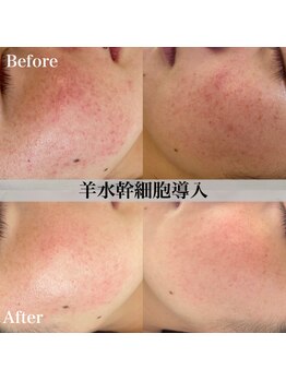 アール アンド ビューティーサロン(Ｒ＆ BeautySalon)/ホワイトニング・赤ら顔にも◎