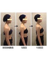 小顔フェイスラボ 四日市店(小顔FaceLabo.)/◆小顔&整体コルギで姿勢改善◆