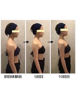 小顔フェイスラボ 四日市店(小顔FaceLabo.)/◆小顔&整体コルギで姿勢改善◆