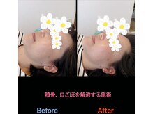 美容矯正サロン レレポノ(LELEPONO)/