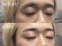 フェリーチェ アイラボ(felice eye lab)