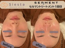 シエスタ(siesta)/初回艶玉肌トリートメント