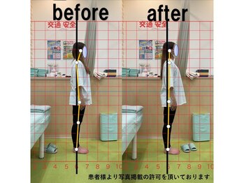 よし鍼灸接骨院 東花園院/施術効果【整体/骨盤矯正/大阪】