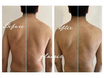 プレジールサロン(plaisir salon)/◇ピラティス+筋膜リリース◇