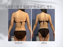 ジュプン 長崎/ブライダルエステ