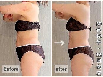 ヒールプラス(heal+)