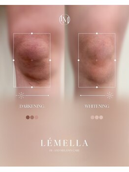 ピュアソル 福岡店(Puresol)/ルメラ