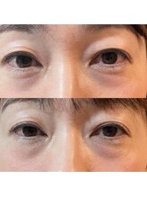 ココシア(cococia)/切らないくま取り