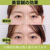 ぬまた鍼灸院