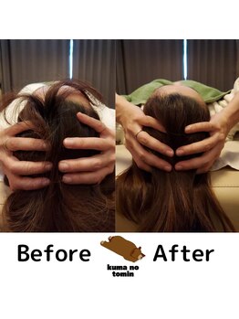 クマの冬眠 高知店/アタマほぐし