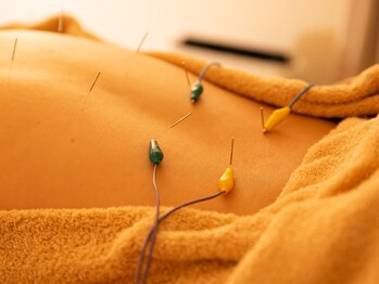 ハリ パール(HARI PEARL)/全身美容鍼灸/コリ解消 腰痛