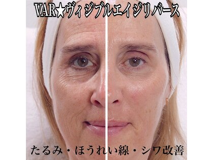 ラ セラフィータ 中目黒の写真