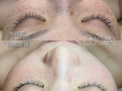 ルシアル(LUCIAL)の写真