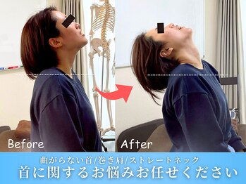 ワト(WATO)/■首に関するお悩みお任せ下さい