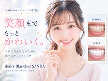 ダンブランシュサンダ(dents Blanches SANDA)の雰囲気(独自の5工程で白さを追求|兵庫県三田市のホワイトニングコース)