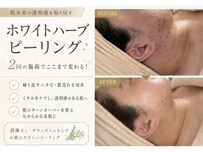 アリュメント(Allument)の写真