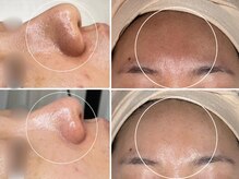ミハン ボーテ(mihan.beaute)の雰囲気（【黒ずみ・毛穴ひらき】5種のピーリングで毛穴トラブルも解決♪）