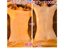 サイオン(SAION)/