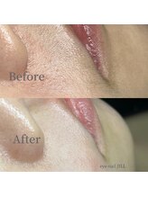 ジル(JILL)/トリプルWAX部分パーツ