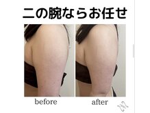 サロンフロム つくば店(Salon From)/◆二の腕セルゼロ◆