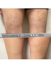 ブラックスワン(Black Swan)/